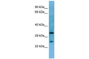 Western Blotting (WB) image for anti-Homeobox A6 (HOXA6) (N-Term) antibody (ABIN2779766) (HOXA6 anticorps  (N-Term))