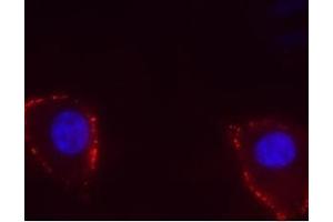 Expression of TRPV4 in human U-87 cells - Cell surface detection of TRPV4 in live intact human brain glioblastoma U-87 cells.