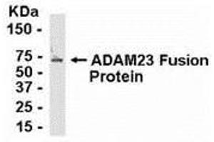Western Blotting (WB) image for anti-ADAM Metallopeptidase Domain 23 (Adam23) (AA 72-144) antibody (ABIN2467991) (Adam23 anticorps  (AA 72-144))