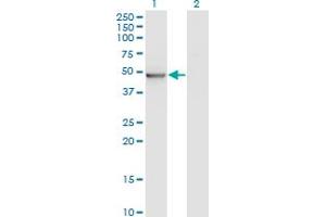 Western Blot analysis of ZMYND10 expression in transfected 293T cell line by ZMYND10 monoclonal antibody (M05), clone 3A6.