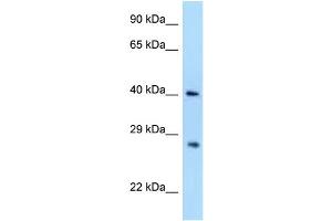 WB Suggested Anti-AIDA Antibody Titration: 1. (AIDA anticorps  (N-Term))