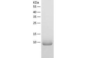 Western Blotting (WB) image for S100 Calcium Binding Protein A3 (S100A3) (AA 1-101) protein (His-IF2DI Tag) (ABIN7124956)