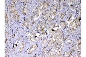 IHC analysis of MMP10 using anti-MMP10 antibody (A03759).