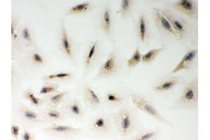 IHC analysis of LYRIC using anti-LYRIC antibody .