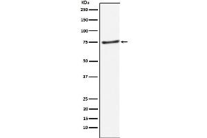 Western blot analysis of PIAS1 expression in Daudi cell lysate.