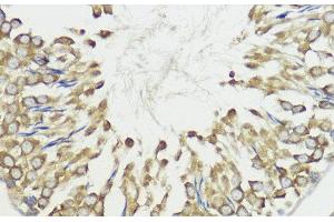 Immunohistochemistry of paraffin-embedded Rat testis using HACE1 Polyclonal Antibody at dilution of 1:100 (40x lens).