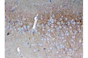 IHC analysis of SAP102 using anti-SAP102 antibody .