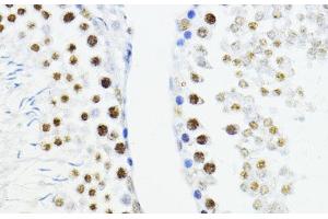 Immunohistochemistry of paraffin-embedded Rat testis using ZEB1 Polyclonal Antibody at dilution of 1:200 (40x lens).