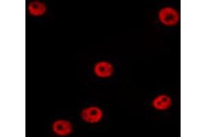 ABIN6274381 staining HepG2 by IF/ICC. (MAPK6 anticorps  (Internal Region))