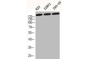 Western Blot analysis of 823 22RV1 293-UV cells using COL1A2 Polyclonal Antibody