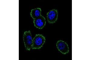 Confocal immunofluorescent analysis of NMB Antibody (Center) (ABIN651541 and ABIN2840290) with MDA-M cell followed by Alexa Fluor 488-conjugated goat anti-rabbit lgG (green). (Neuromedin B anticorps  (AA 15-42))
