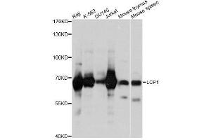 Western blot analysis of extracts of various cell lines, using LCP1 antibody. (LCP1 anticorps  (AA 1-270))