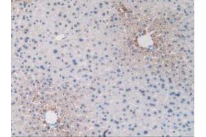 IHC-P analysis of Mouse Liver Tissue, with DAB staining. (Endoglin anticorps  (AA 27-137))