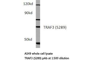 Western blot (WB) analysis of TCF-3 antibody in extracts from hela cells. (TCF3 anticorps)