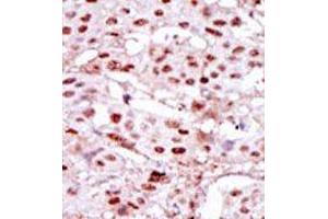 Image no. 2 for anti-Casein Kinase 2 alpha 1 (CSNK2A1) (Middle Region) antibody (ABIN360651) (CSNK2A1/CK II alpha anticorps  (Middle Region))