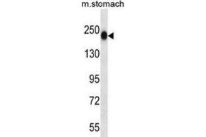 Western Blotting (WB) image for anti-Tenascin N (TNN) antibody (ABIN2997436) (Tenascin N anticorps)