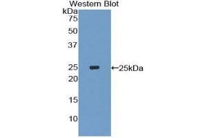Western Blotting (WB) image for anti-Interleukin-27 Subunit alpha (IL27) (AA 29-234) antibody (ABIN1859409) (IL27 anticorps  (AA 29-234))