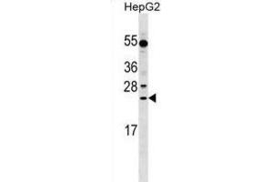 Western Blotting (WB) image for anti-Leucine Rich Repeat Containing 29 (LRRC29) antibody (ABIN2999686) (LRRC29 anticorps)