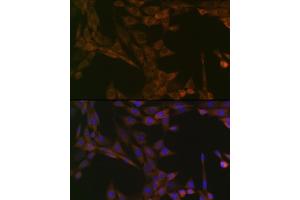 Immunofluorescence analysis of NIH-3T3 cells using SMYD3 Rabbit mAb (ABIN3015902, ABIN3015903, ABIN1680302 and ABIN1680303) at dilution of 1:100 (40x lens). (SMYD3 anticorps)