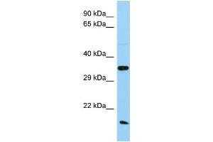 Host: Rabbit Target Name: Ak1 Sample Type: Rat Testis lysates Antibody Dilution: 1. (Adenylate Kinase 1 anticorps  (Middle Region))