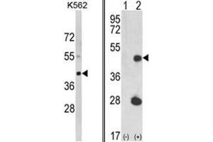 (LEFT) Western blot analysis of LUC7L Antibody (C-term) in K562 cell line lysates (35ug/lane). (LUC7L anticorps  (C-Term))