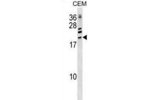 Western Blotting (WB) image for anti-Activating Transcription Factor 3 (ATF3) antibody (ABIN2998842) (ATF3 anticorps)