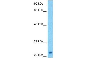 Host:  Rabbit  Target Name:  ASCL1  Sample Type:  RPMI-8226 Whole Cell lysates  Antibody Dilution:  1. (ASCL1 anticorps  (N-Term))