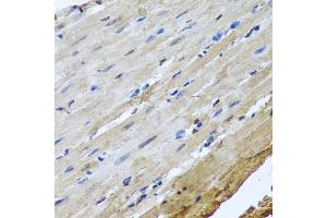 Immunohistochemistry of paraffin-embedded rat heart using NUMA1 antibody. (NUMA1 anticorps)