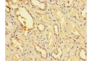 Immunohistochemistry of paraffin-embedded human kidney tissue using ABIN7173726 at dilution of 1:100