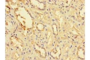 Immunohistochemistry of paraffin-embedded human kidney tissue using ABIN7173726 at dilution of 1:100 (TPPP3 anticorps  (AA 2-176))