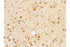 ABIN6267283 at 1/100 staining human brain tissue sections by IHC-P. (ErbB2/Her2 anticorps  (pTyr1248))