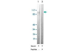 Western blot analysis of extracts from NIH/3T3 cells treated with serum (10%, 30 mins), using EEF2 polyclonal antibody .