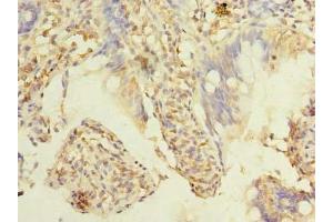 Immunohistochemistry of paraffin-embedded human small intestine tissue using ABIN7173386 at dilution of 1:100 (TMEM38B anticorps  (AA 249-291))