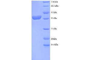 Ribosomal Protein S12 (RPS12) (AA 1-132), (full length) protein (GST tag) (RPS12 Protein (AA 1-132, full length) (GST tag))