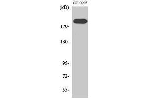 Western Blotting (WB) image for anti-DNA Repair Protein Complementing XP-G Cells (ERCC5) (N-Term) antibody (ABIN3187504) (ERCC5 anticorps  (N-Term))