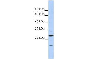 WB Suggested Anti-INSIG2 Antibody Titration:  0. (INSIG2 anticorps  (N-Term))