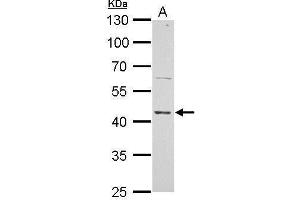WB Image ERCC8 antibody detects ERCC8 protein by Western blot analysis.