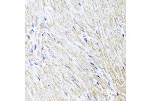 Immunohistochemistry of paraffin-embedded mouse heart using L2HGDH antibody. (L2HGDH anticorps)