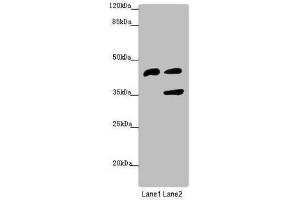 Western blot All lanes: SERPINB6 antibody at 0. (SERPINB6 anticorps  (AA 180-300))