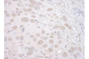 Immunohistochemistry (IHC) image for anti-Catenin, beta Like 1 (CTNNBL1) (AA 1-50) antibody (ABIN7448501) (CTNNBL1 anticorps  (AA 1-50))