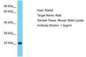 Image no. 1 for anti-V-Ral Simian Leukemia Viral Oncogene Homolog B (Ras Related, GTP Binding Protein) (Ralb) (AA 97-146) antibody (ABIN6750361)