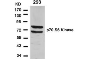 Image no. 3 for anti-Ribosomal Protein S6 Kinase, 70kDa, Polypeptide 1 (RPS6KB1) (Ser411) antibody (ABIN197526) (RPS6KB1 anticorps  (Ser411))