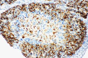 Anti-HSD17B1 antibody, IHC(P): Rat Ovary Tissue