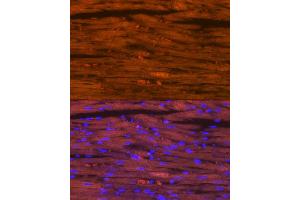 Immunofluorescence analysis of rat heart using Myosin heavy chain Rabbit mAb (ABIN7268750) at dilution of 1:100 (40x lens).