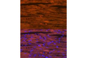 Immunofluorescence analysis of rat heart using Myosin heavy chain Rabbit mAb (ABIN7268750) at dilution of 1:100 (40x lens). (MYH7 anticorps)