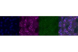 Immunohistochemistry (IHC) image for anti-Kv Channel Interacting Protein 2 (KCNIP2) antibody (ABIN7456313) (KCNIP2 anticorps)