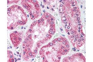 Anti-ULK1 antibody IHC of human kidney. (ULK1 anticorps  (AA 320-370))