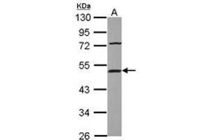 Image no. 1 for anti-Suppression of Tumorigenicity 13 (ST13) (AA 166-369) antibody (ABIN1501165) (HSC70 Interacting Protein HIP anticorps  (AA 166-369))