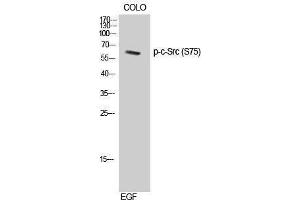 Western Blotting (WB) image for anti-Proto-oncogene tyrosine-protein kinase Src (Src) (pSer75) antibody (ABIN3179706) (Src anticorps  (pSer75))