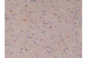 IHC-P analysis of Human Brain Tissue, with DAB staining. (NFkB anticorps  (AA 805-892))
